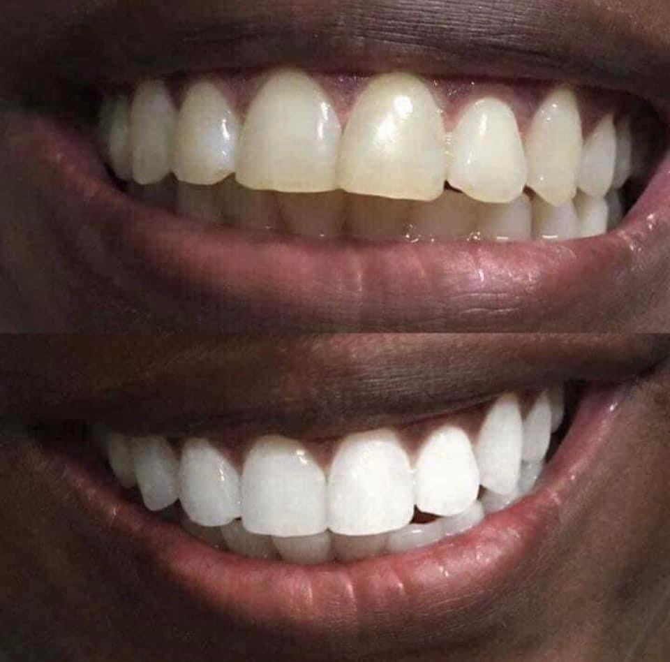 1  AP24 whitening Toothpaste and 1 bottle Sunright InstaGlow self tanner