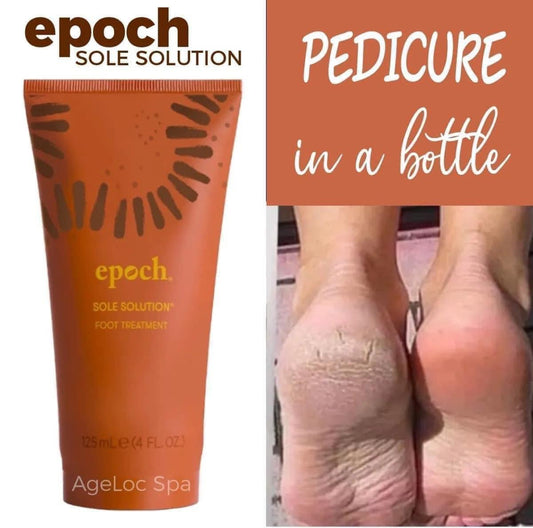 Epoch Sole Solutions